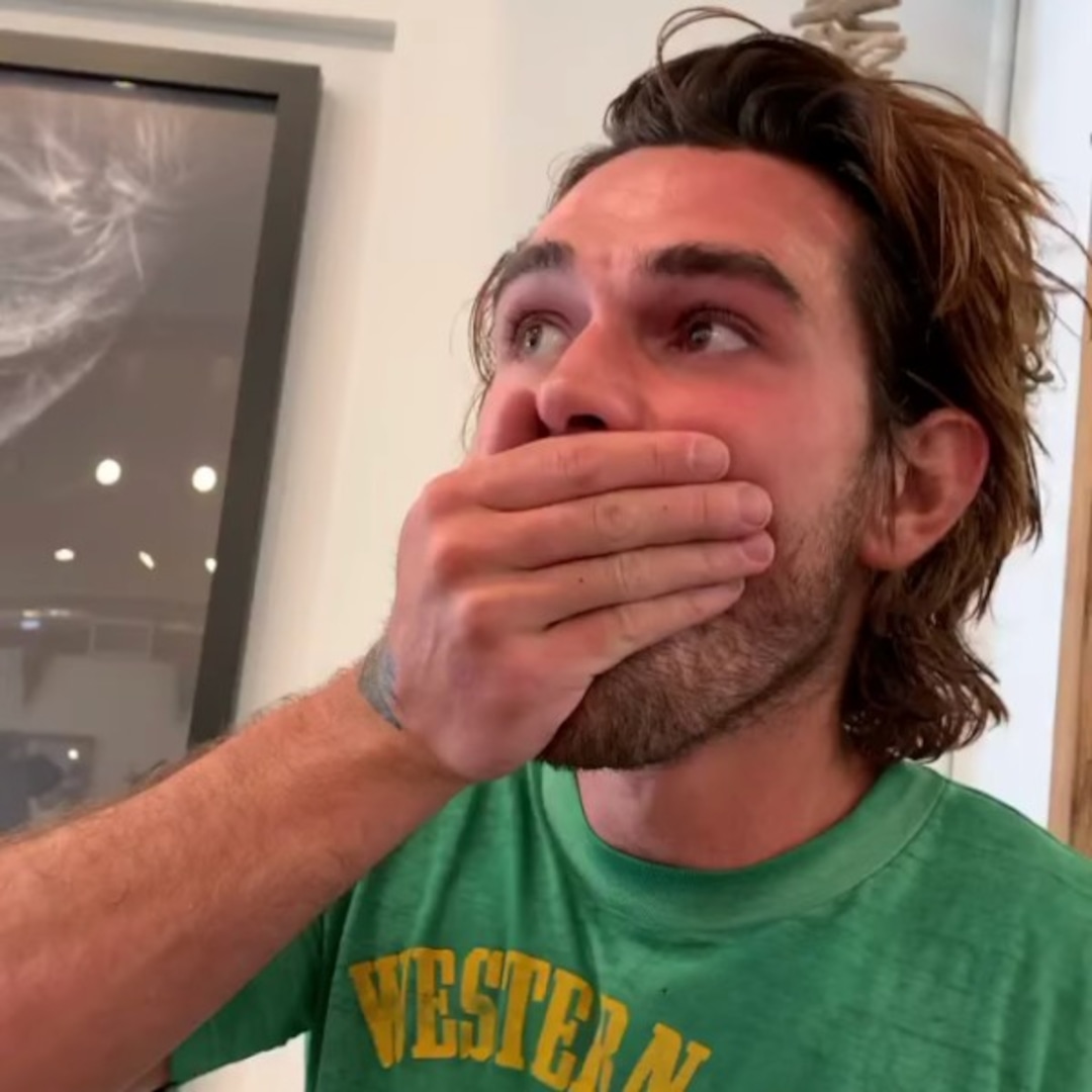 KJ Apa Bursts Into Tears After Removing "Shard of Metal" From His Eye